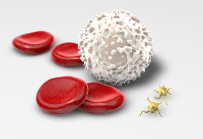 Celulas sanguineas, celulas do sangue, células sanguíneas, células do sangue, hemacias, hemácias, glóbulos vermelhos, globulos vermelhos, granulocitos, granulócitos, agranulocitos, quantidade de sangue no corpo, leucocitos normais, qual o valor normal de linfocitos no sangue, leucócitos normal, função das hemácias, o que são eritrócitos, leucocitos valores de referencia, porque o sangue é vermelho, eritrócitos o que é, função da medula ossea, granulócitos e agranulócitos, glóbulos vermelhos e brancos, função dos globulos vermelhos, o que são globulos vermelhos , globulos vermelhos função, doenças sanguineas, leucócitos normais, qual a função dos globulos vermelhos, celulas sanguineas e suas funções , função das hemacias, tipos de celulas sanguineas , baixa de leucocitos, linfocitos acima do normal, doenças relacionadas ao sangue, celulas hematologicas, leucocitos acima, leucocitos hemograma, leucócitos abaixo do normal, globulos vermelhos e brancos, como aumentar as plaquetas depois da quimioterapia, formação das celulas sanguineas, celulas jovens, celula normal , onde são produzidas as celulas sanguineas, quais são as celulas do sangue, sangue, composição do sangue, componentes do sangue, celulas do sangue, o que é plasma, função do plasma plasma sanguineo, quais os componentes do sangue, onde o sangue é produzido, elementos do sangue, cancer no sangue, cancer sangue, celulas tumorais, células tumorais, cancer do sangue, celulas normais e celulas cancerigenas , celulas cancer, leucemia tem cura cancer linfoma, coçeira no corpo todo o'que pode ser cancer, cancer de sangue, cancer na medula, manchas roxas nas pernas pode ser leucemia, aumento do baço, leucemia manchas, leucemia no sangue, leucemia é cancer, cancer no sangue sintomas, sintomas de leucemia no sangue, linfoma no sangue, tipos de cancer no sangue, plaquetas normais plaquetas funcao, plaquetas baixas, plaquetas altas, como aumentar as plaquetas, plaquetas para que serve, plaquetas sao celulas, plaquetas baixas sintomas, leucemia, casos de leucemia, exame de sangue, alguns tipos de leucemia, transplante de medula óssea, tratamento pode, medula óssea é, células linfoides, leucemias podem, tipo da doença, tipos de glóbulos brancos, sintomas de leucemia, leucemia sintomas, leucemia mieloide aguda, sintomas leucemia, o que é leucemia, o que causa leucemia, o que causa a leucemia, linfoma, sistema linfático. gânglios linfáticos, linfoma pode, sistema imunológico, perda de peso, casos de linfomas, célula maligna, linfoma é, podem ocorrer, glóbulos brancos pescoço axilas e virilha, partes do corpo, vasos linfáticos, linfoma de hodgkin , linfoma não hodgkin, linfoma sintomas, o que é linfoma, o que é linfoma, linfoma o que é, o que é linfoma e quais os sintomas, quanto tempo de vida tem uma pessoa com linfoma, ingua no pescoço, inchaço abdominal e linfoma