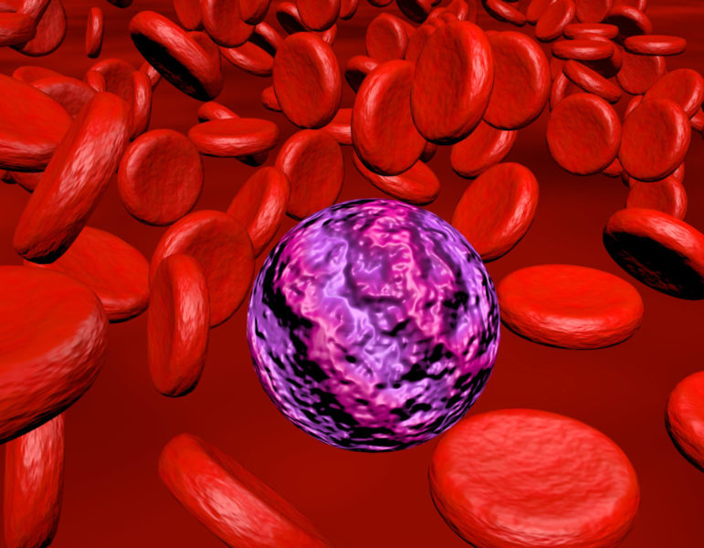 ash, ash congress 2020 highlights, recidivado, leucemia linfocítica cronica, refratariedade ao tratamento, leucemia linfoblastica aguda, leucemia linfoblastica, celulas nk, leucemia linfoide cronica, leucemia linfoide crônica, lla, leucemia linfocítica crônica, tratamento da leucemia tratamento de leucemia, tratamento de leucemia mieloide aguda, tratamento da leucemia mieloide cronica, tratamento de leucemia linfoide aguda, tratamentos para leucemia linfoide crônica, tipos de leucemia e tratamento, tratamento de leucemia infantil, tratamento inovador de leucemia, tempo de tratamento leucemia, tratamento de leucemia aguda, tratamento de leucemia pelo transplante de medula óssea, como é o tratamento de leucemia, tratamento de leucemia mieloide cronica, qual tratamento de leucemia, leucemia, leucemia tem cura, cancer no sangue, leucemia aguda, leocemia, leucemia cronica leucemias, câncer no sangue, cancer de sangue, leucemia infantil, como funciona a quimioterapia, leucemia tratamento, leucemia no sangue, tratamento leucemia, tratamento para leucemia, tratamento da leucemia, leucemia tem cura?, tratamento de leucemia, leucemia é cancer, quimioterapia como funciona, tratamentos para leucemia, leucemia mieloide aguda tem cura, remedio para leucemia, azacitidina, venetoclax, imatinibe, dasatinibe, nilotinibe, ponatinibe, bosutinibe, asciminibe, ibrutinibe, rituximabe, Citarabina, azacitidina, venetoclax, gilteritinibe, blinatumomab, leucemia mieloide aguda, leucemia linfoide aguda, leucemia mieloide cronica, leucemia linfoide cronica, imunoterapia, quimioterapia, crise blástica