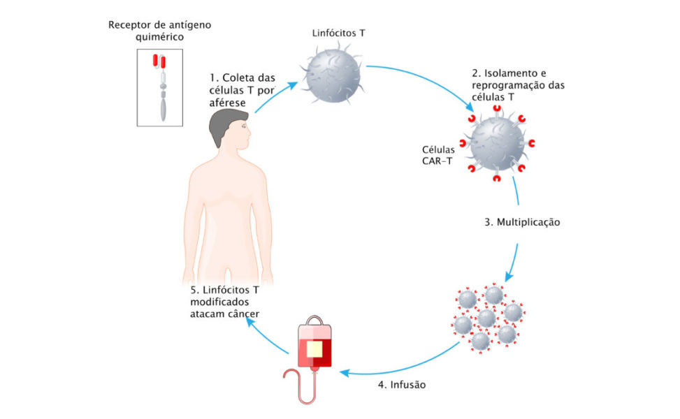 Explicação De Como Funciona O Tratamento De Cancer Com A Car-t Cell