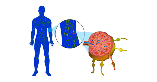 Linfoma Difuso De Grandes Celulas B Tipo Centro Germinativo