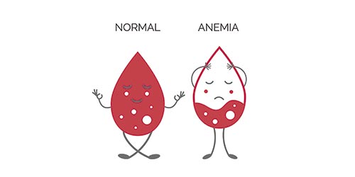 Duas gotas de sangue lado a lado sendo que uma delas está com anemia