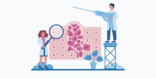 Ilustração de profissionais médicos examinando células com lupa e biópsia, simbolizando exames usados no diagnóstico de linfoma de Hodgkin.