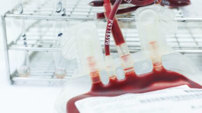 Saiba se você pode ou não fazer um transplante de medula óssea (TMO)