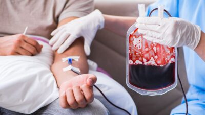 Conheça os subtipos da síndrome mielodisplásica